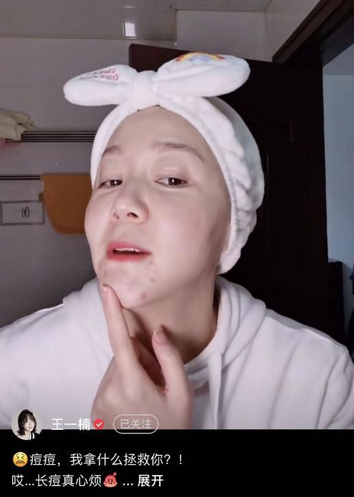 小秦氏王一楠素颜直播，满脸痘不遮掩，不忘与老公高鑫秀恩爱超甜