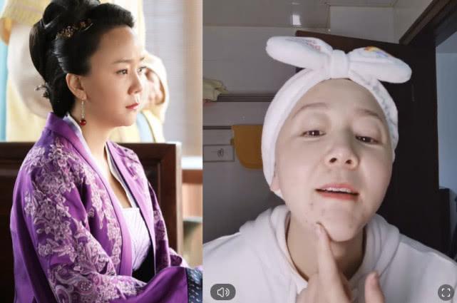 小秦氏王一楠素颜直播，满脸痘不遮掩，不忘与老公高鑫秀恩爱超甜